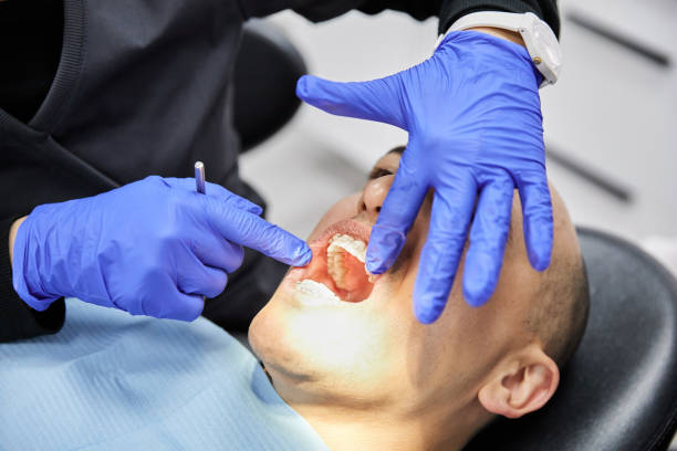 Best Emergency Tooth Extraction in Merriam, KS