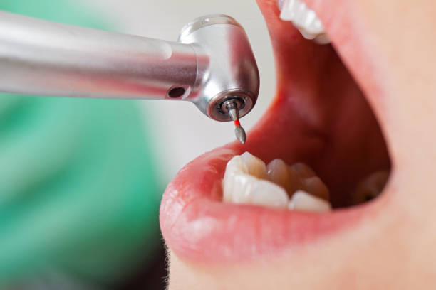 Best Emergency Denture Repair in Merriam, KS